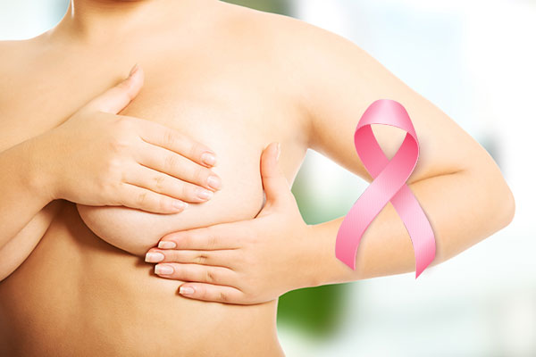 How to Perform a Breast Self-Exam